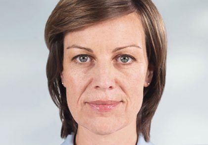 Sculptra Before & After