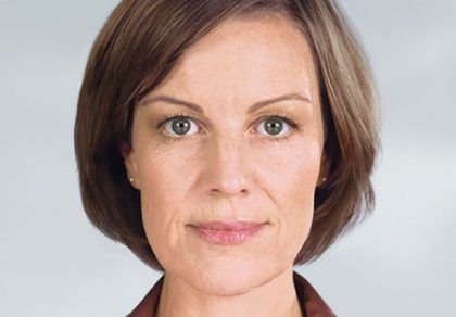 Sculptra Before & After