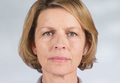 Sculptra Before & After