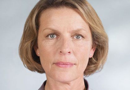 Sculptra Before & After