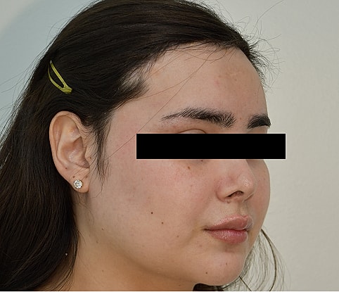 MTF Hair Gallery Before & After