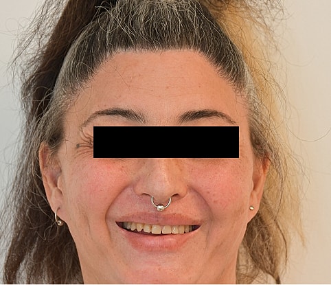 MTF Hair Gallery Before & After