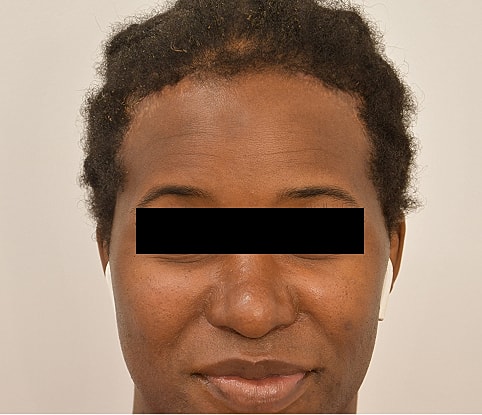 MTF Hair Gallery Before & After