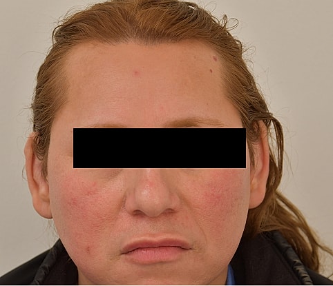 MTF Hair Gallery Before & After