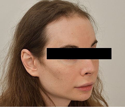 MTF Hair Gallery Before & After