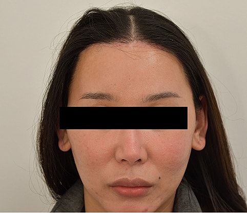 MTF Hair Gallery Before & After