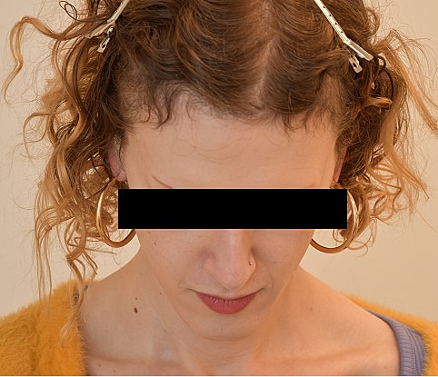 MTF Hair Gallery Before & After