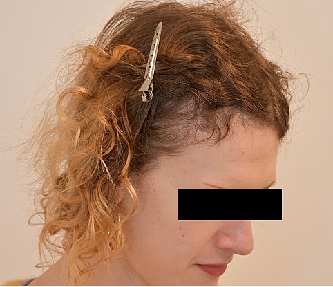 MTF Hair Gallery Before & After