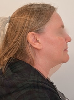 Profile view of a woman with blended images.