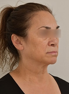 Profile of a woman with tied-back hair.