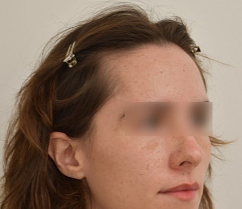 Woman with hair clips looking sideways.