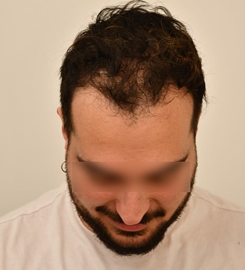Man looking down with short, wavy hair.