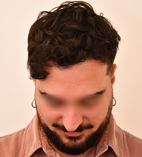 Person with curly hair looking downwards.