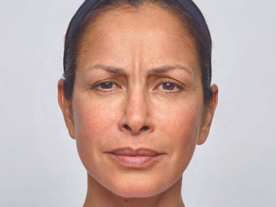 Neurotoxins Before & After