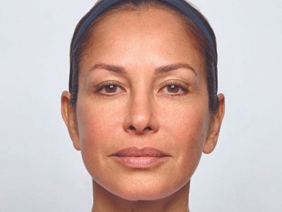 Neurotoxins Before & After