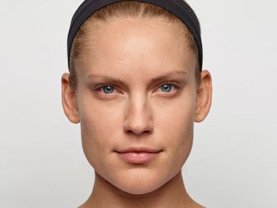 Neurotoxins Before & After