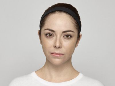 Neurotoxins Before & After