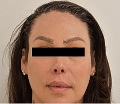 Gender Affirming Hair Before & After