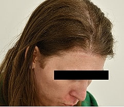 Gender Affirming Hair Before & After