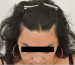 Gender Affirming Hair Before & After