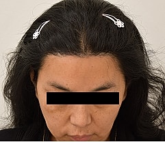 Gender Affirming Hair Before & After