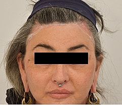 Gender Affirming Hair Before & After