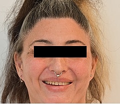 Gender Affirming Hair Before & After