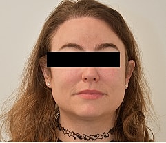 Gender Affirming Hair Before & After