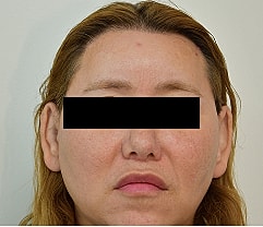 Gender Affirming Hair Before & After