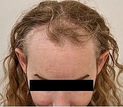 Gender Affirming Hair Before & After