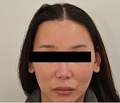 Gender Affirming Hair Before & After