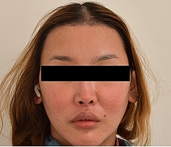 Gender Affirming Hair Before & After