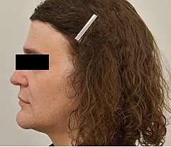 Gender Affirming Hair Before & After