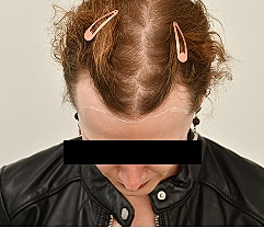 Gender Affirming Hair Before & After