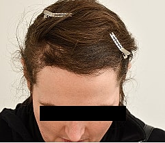 Gender Affirming Hair Before & After