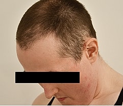 Gender Affirming Hair Before & After