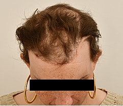 Gender Affirming Hair Before & After