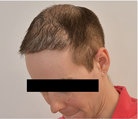 Gender Affirming Hair Before & After