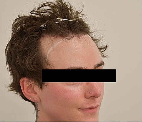 Gender Affirming Hair Before & After