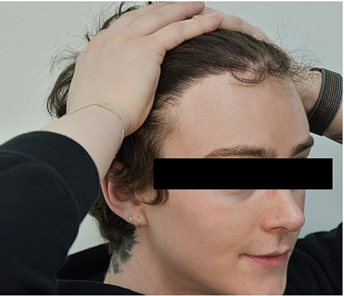 Gender Affirming Hair Before & After