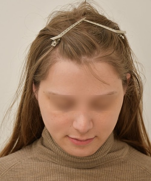 Person with hair clips and turtleneck top.