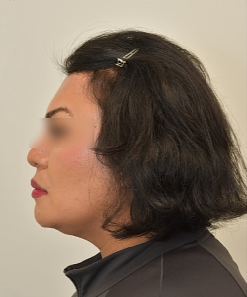 Profile of a person with dark, wavy hair.