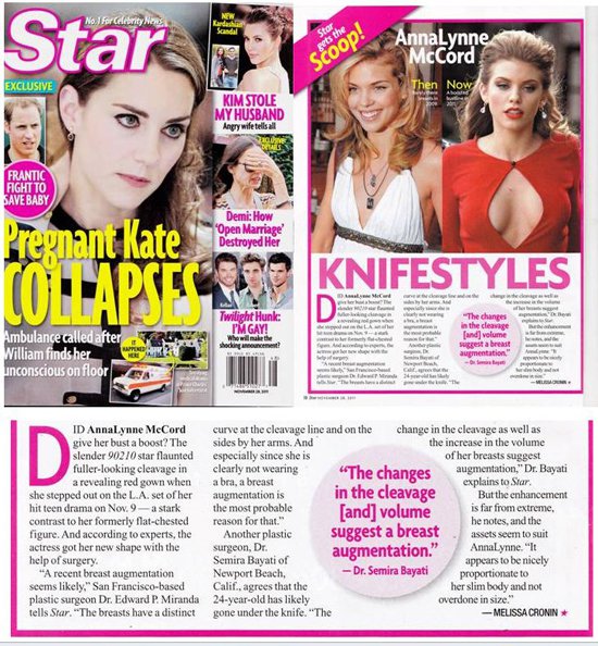 Pacific Plastic Surgery Group San Francisco in Star Magazine