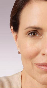 Dermal Fillers Before & After Image